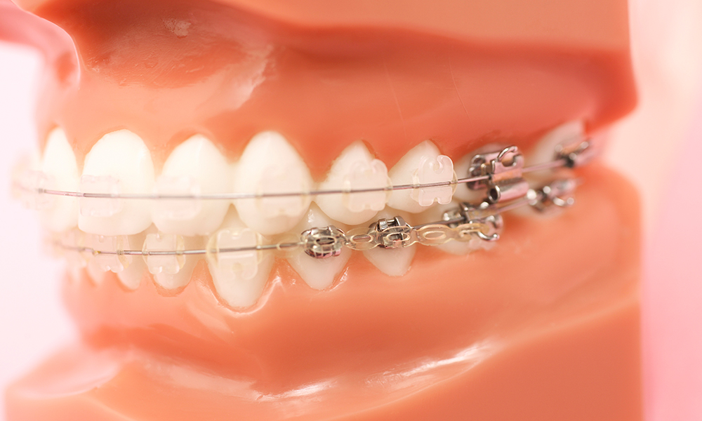 正しい歯並びは健康の基盤です
